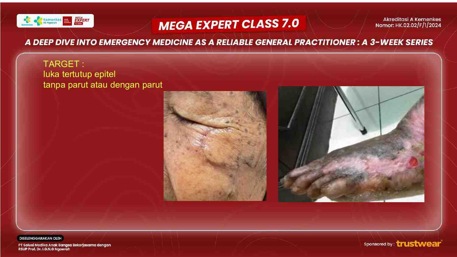 [week-3]-comprehensive-wound-management-strategies-for-inpatient-care-260
